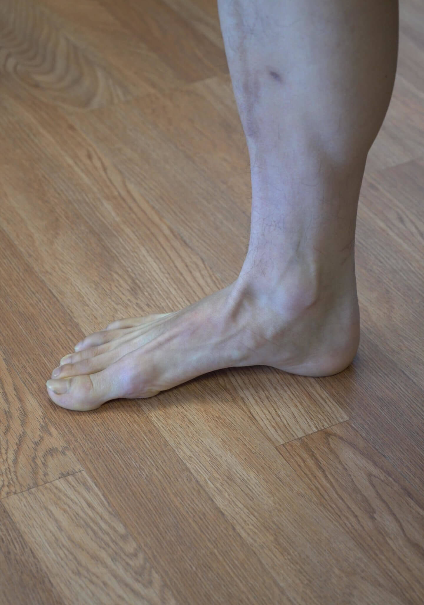 Seated Short Foot (Arch Lift) [P]rehab