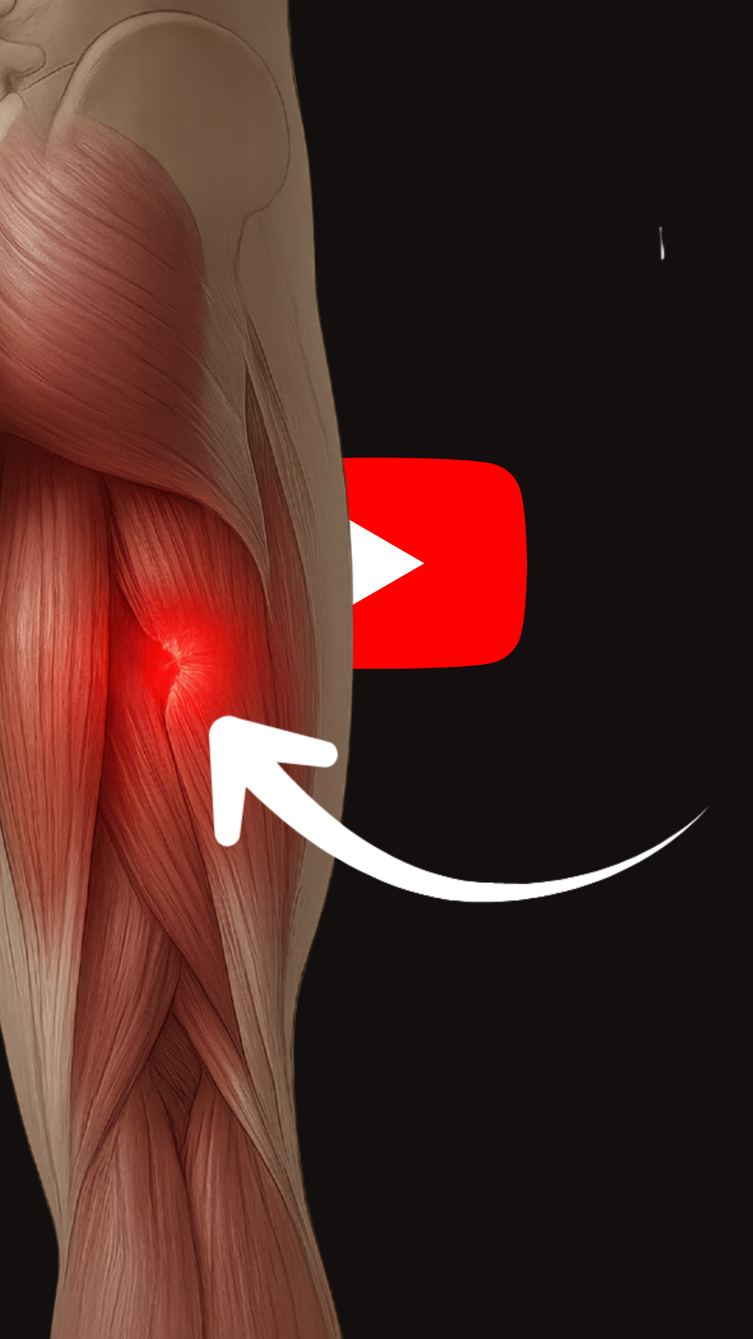 How Long to Get Back to Sport after a Hamstring Strain? Recovery Tips ...